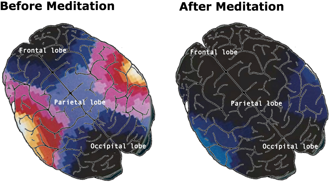 After brain. Влияние медитации на мозг. Медитация влияет а мозг. Карта мозга до медитации и после. Brain after Meditation.
